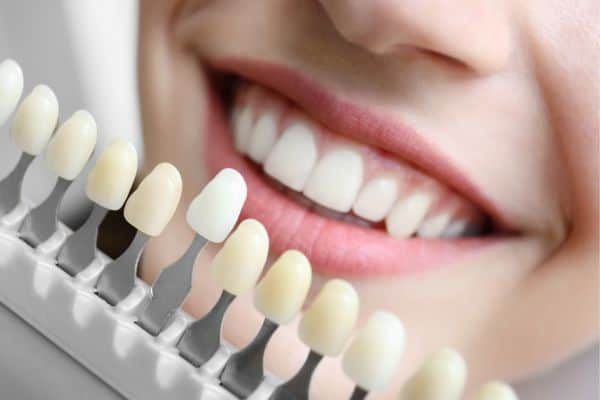 fastest whitening