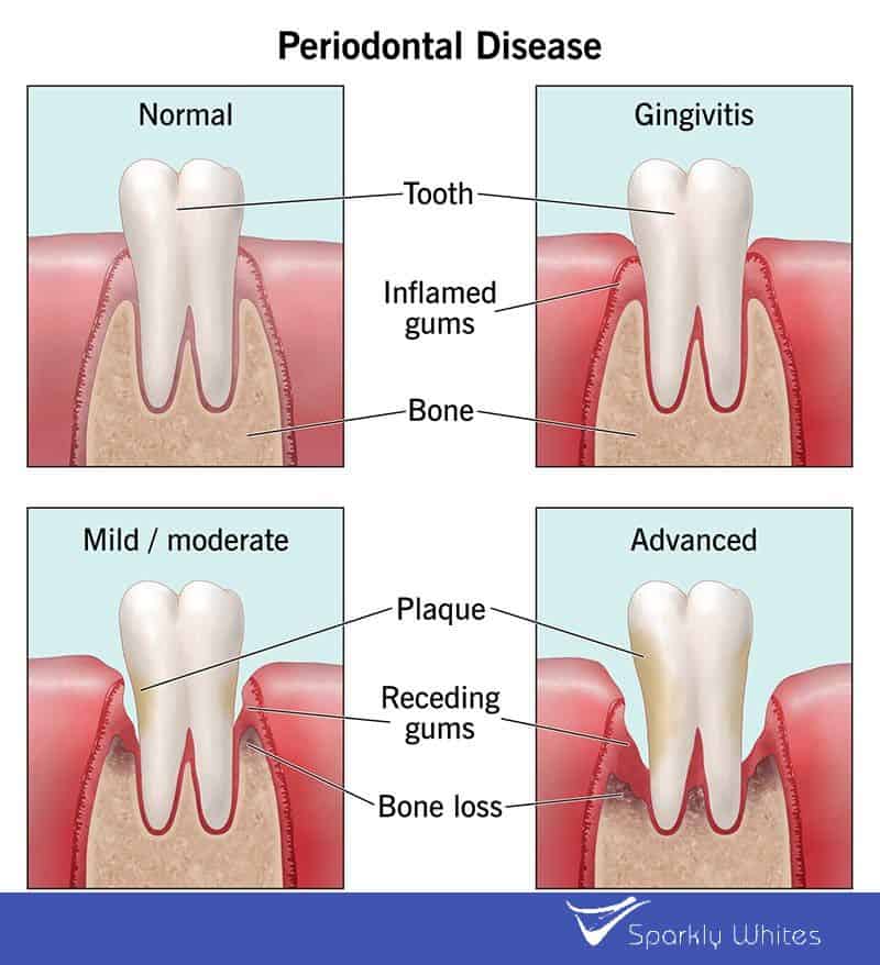If Your Gums Could Talk, What Would They Say About Your Health Banbury?