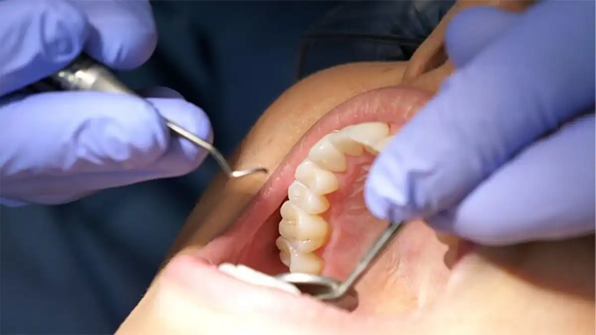 What's The Actual Difference Between Laser and Tray Teeth Whitening—And Why Should You Give a Floss Banbury?