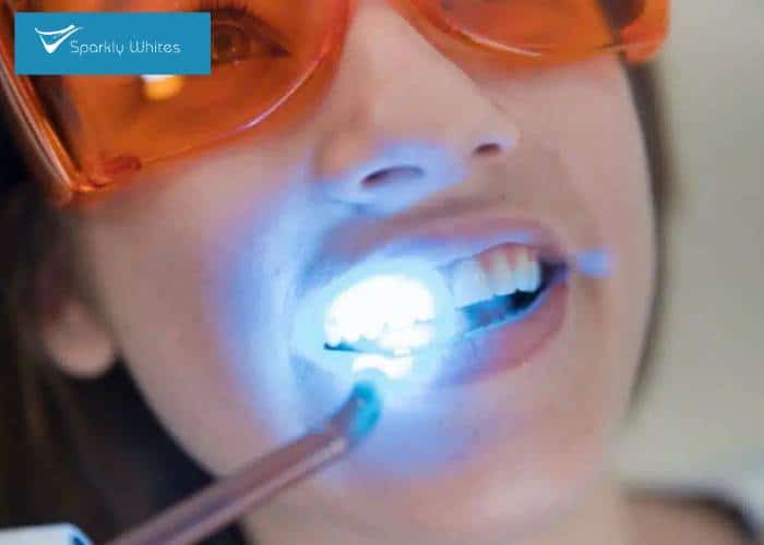Will Whitening Make My Teeth and Dental Work Look Different Banbury?