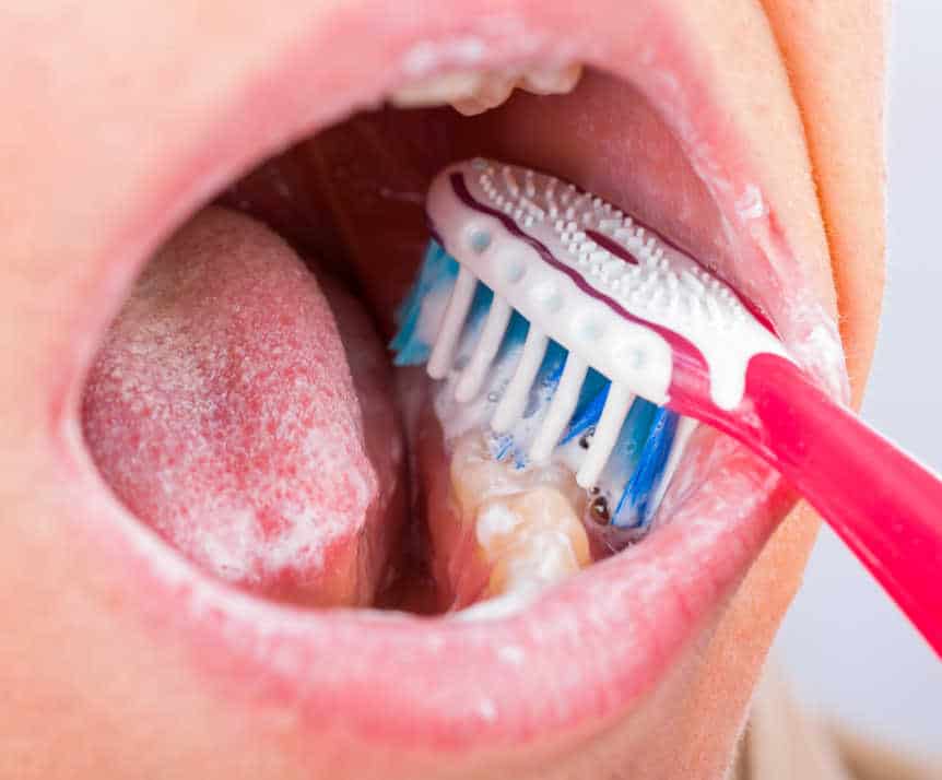 Proper oral hygiene tools, including toothbrush, floss, and mouthwash, essential for maintaining white teeth Banbury